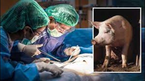 US surgeons successfully transplant pig kidney to human: 'Worked immediately!'