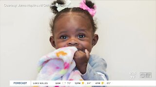 Baby Dream survives two medical malformations to become an inspiration to doctors