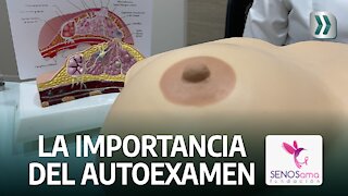 Así debe realizar su autoexamen de seno