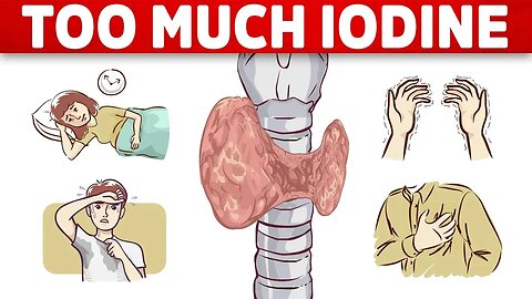 The #1 Sign of Iodine Overload (TOXICITY)