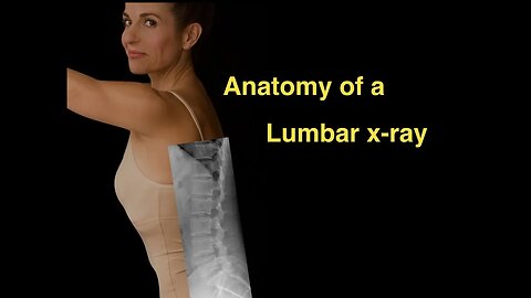 Anatomy of a Lumbar x-ray