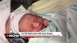 The heart of a lion: Strongsville boy born with heart defect inspires others after fight of his life