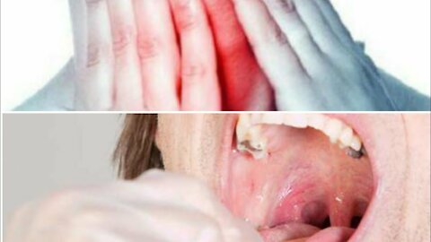 Rinse your mouth several times a day with this remedy and say goodbye to sore mouth and throat