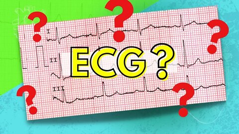 How to Read an Electrocardiogram (ECG/EKG)
