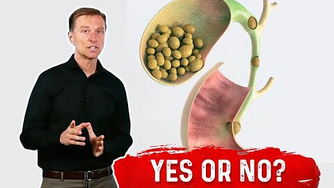 Should I Remove My Gallbladder If I have Stones? – Dr.Berg