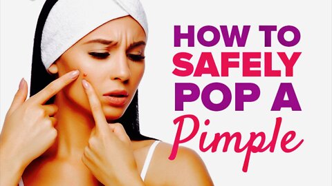 How To Pop Your Pimples Correctly Without Scarring Yourself