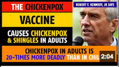 Chickenpox vaccine causes chickenpox and shingles in adults, notes Robert F. Kennedy, Jr