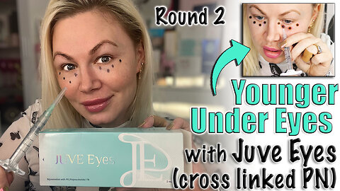 Younger Looking Eyes with Juve Eyes, AceCosm | Code Jessica10 saves you money!