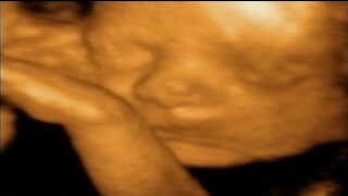 Noah 28 Weeks in Womb Ultrasound 3D Video