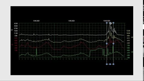 Schumann Resonance August 10 WOW GREEN, Right Eye Awakening, Conscious Humans Stepping Forward