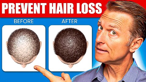 12 Proven Remedies to Prevent Hair Loss and Regrowth Regrow hair