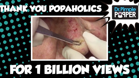 Dr Pimple Popper: THANK YOU, POPAHOLICS FOR ONE BILLION