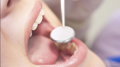 How root canals, mercury fillings can endanger your health