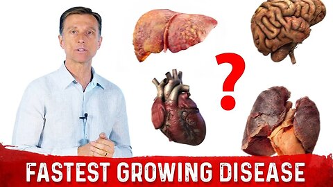 The Fastest Growing Disease in the World is...