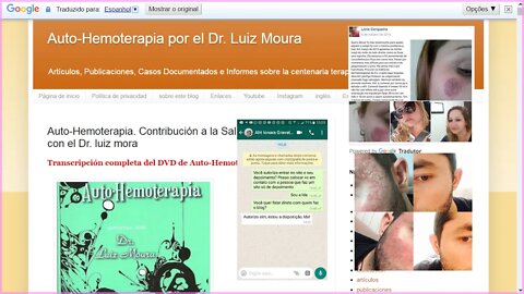 Autohemoterapia. 3 casos de curación de Pénfigo Foliáceo (Wild Fire - fuego salvaje)