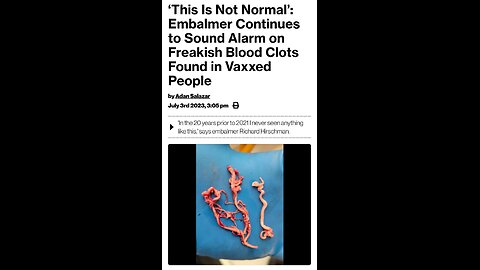 Blood clots after K19! Cancer is parasites! CO2 is harmless!