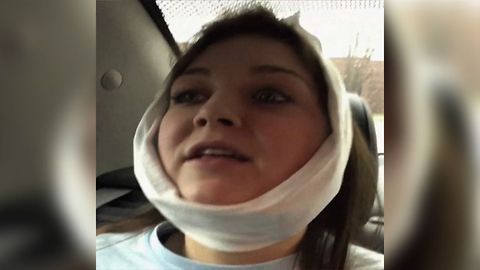The Best Post Wisdom Teeth Surgery Reaction Of All Time