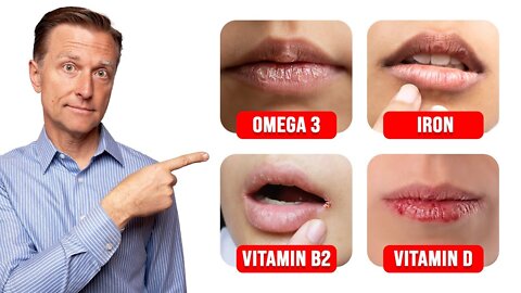 5 Things Your LIPS Can Tell You about Your Nutritional State (3)