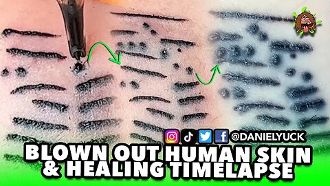 Blowing Out Human Skin & 1 Month Healing Timelapse 🩸