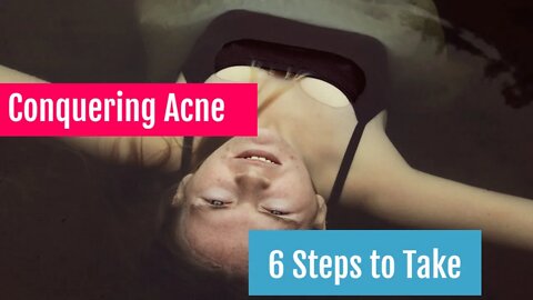 Conquering Acne 6 Steps to Take