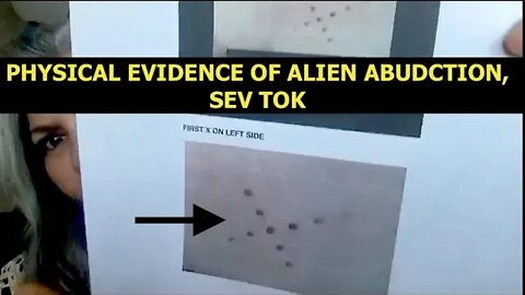 Physical Evidence of Alien Abduction, The Rabbit Hole Runs Deep, Sev Tok, Latest