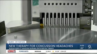 UArizona researchers test potential therapy for concussion-related headaches