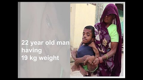 22 year old man having 19 kg weight