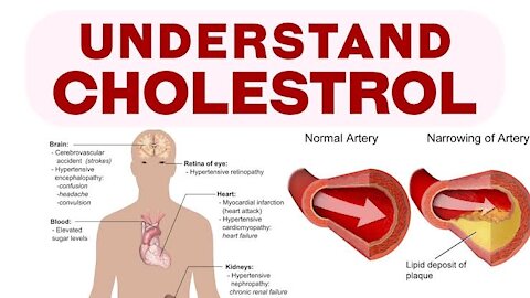 The Best Food For Lowering High Cholesterol