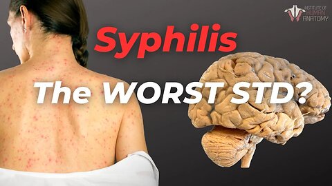 What Syphilis Does to the Body | And Should You Get Tested?