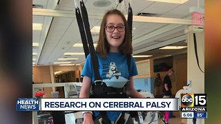Research on Cerebral Palsy