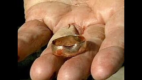 Miracle Marriage: The Wedding Ring That Saved a Life