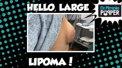 Hello, Lipoma!