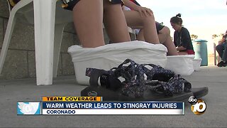 Warm weather leads to stingray injuries