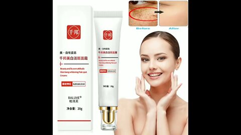 Whitening FreckleCream Remove Melasma Acne Spot Pigment Melanin Dark SpotsPigmentation Moisturizing