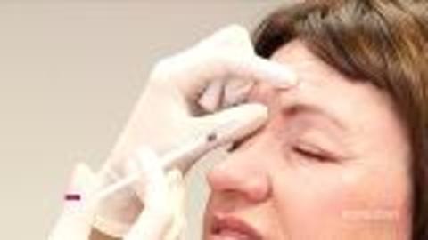What Really Happens During a Botox Appointment