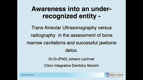 Trans Alveolar Ultrasonography VS Radiography: Assessment of Bone Marrow Cavitations & Jawbone Detox