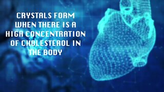 MSU study finds link between cholesterol crystals and bacterial infections in the heart