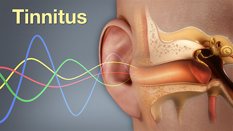 What Is Tinnitus? - 10 Common Causes of Tinnitus (Ringing in the Ears)