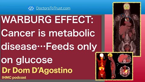 DOM D’AGOSTINO 3a | WARBURG EFFECT: Cancer is metabolic disease…Feeds only on glucose