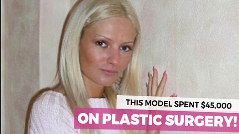 This Is What She Looked Like Before She Spent $45,000 On Surgery. Now Check Out Her After Photos
