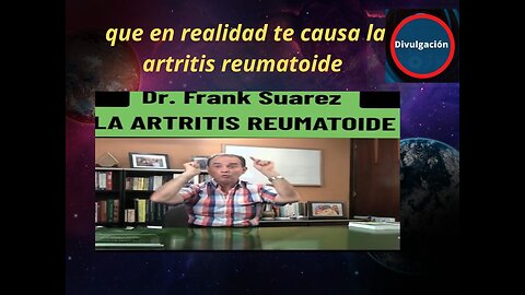 que en realidad te causa la artritis reumatoide