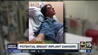 Potential breast implant dangers