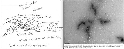 June 5 2022: Remote Viewing: Update to the Update of Ominous Feeling, Amyloid Clots