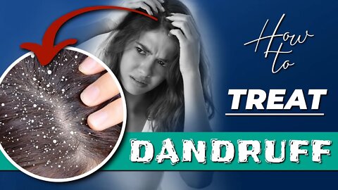 How to GET RID of DANDRUFF || Quick & Easy Treatments