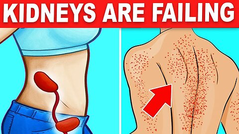 Watch 10 Signs Your Kidneys Are Crying For Help Kidney Failure Symptoms Care Better then Cure