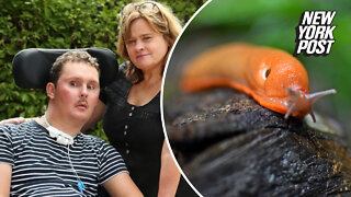 Man dies 8 years after being dared to eat slug