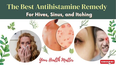 The Best Antihistamine Treatment | Remedy For Hives, Sinus, and Itching