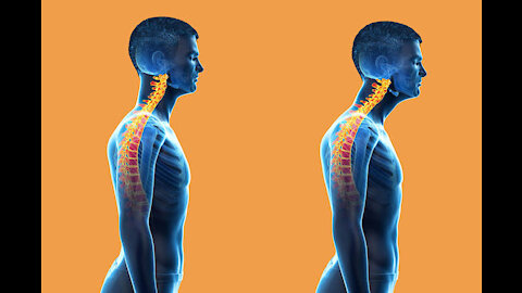 Stretches to Improve Forward Head Posture