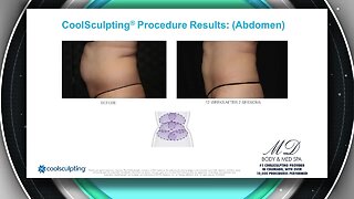 MD Body and Med Spa - Coolsculpting