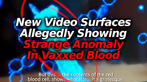 New Video Alleges Strange Object Detected In Vaccinated Blood Under Microscope, Graphene?